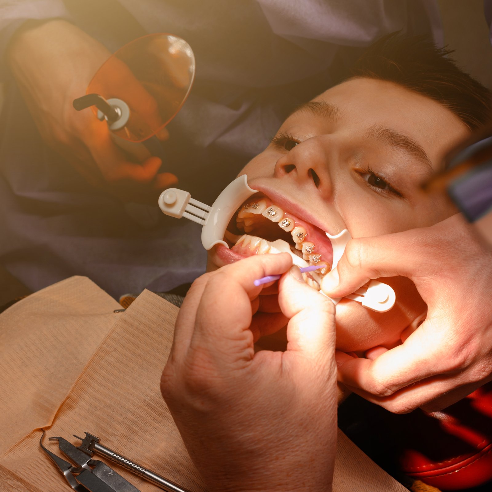 Oral Maxillofacial Surgery and Prosthetic Care After Cancer