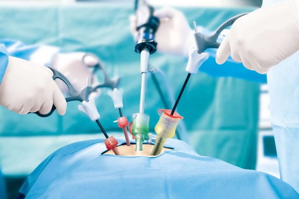 Gynaecological Laparoscopy — Minimally Invasive Surgery
